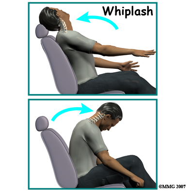 whiplash_intro01.jpg