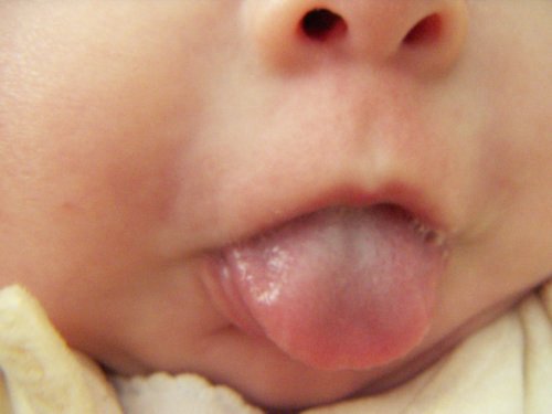 lengua.jpg
