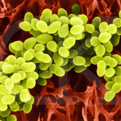 staphylococcus-aureus.jpg