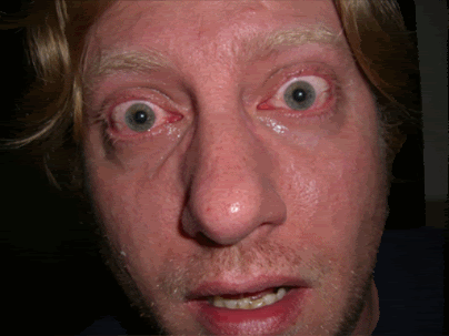 ekgec8jpg-1.gif