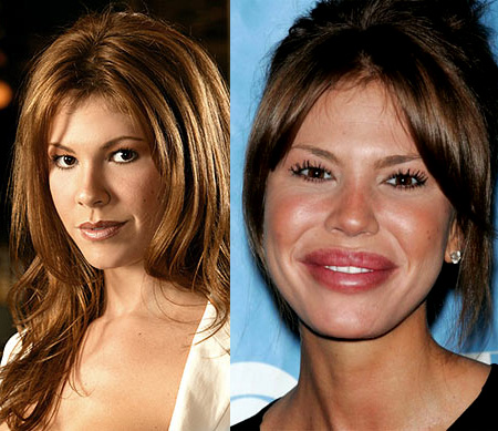 nikki-cox-botox.jpg