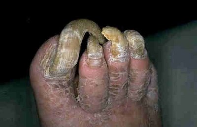ugly-feet.jpg