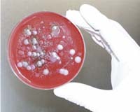 anthrax-virus-petri-dish-bg.jpg